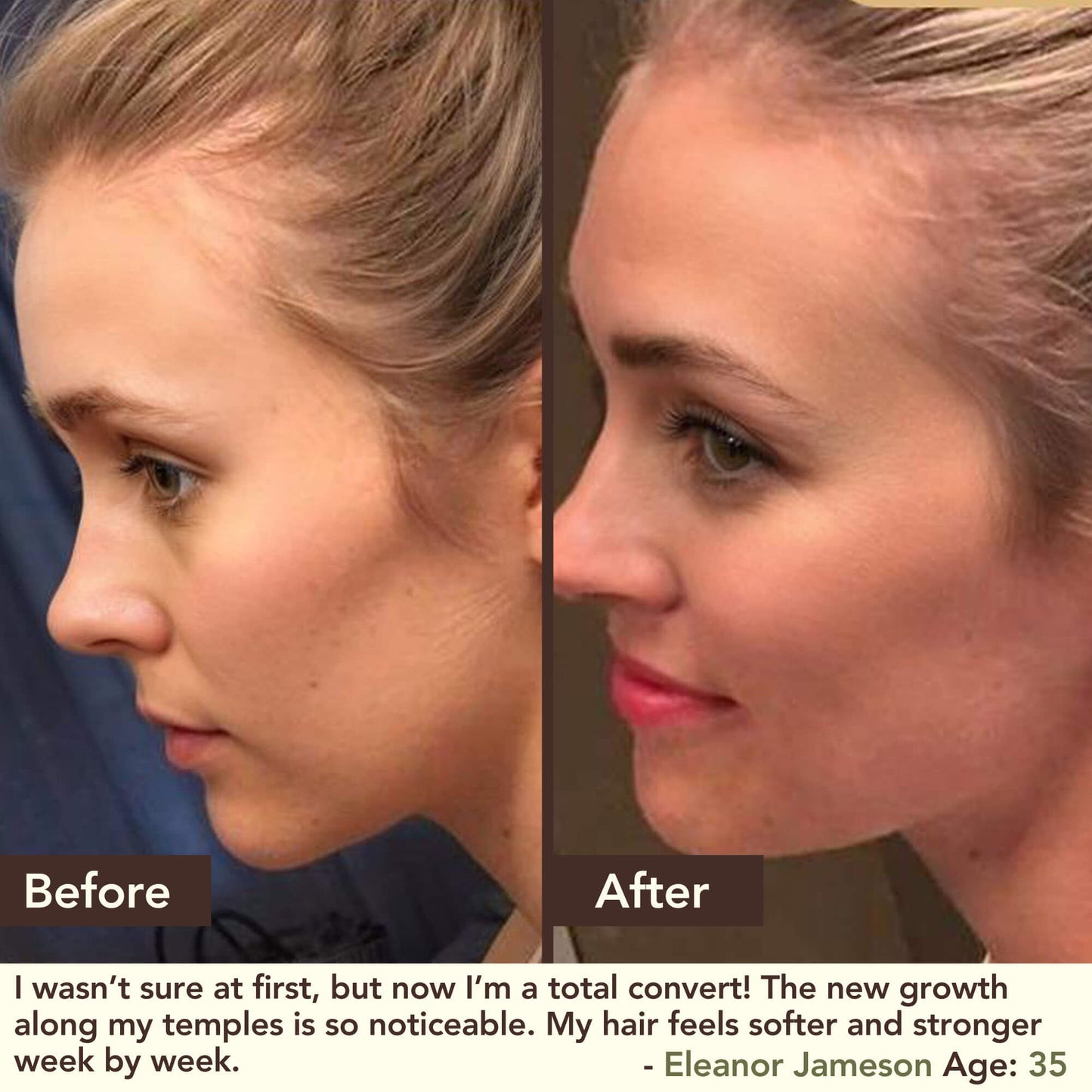 SHIKAKAI + BHRINGRAJ Hair Growth Scalp Serum