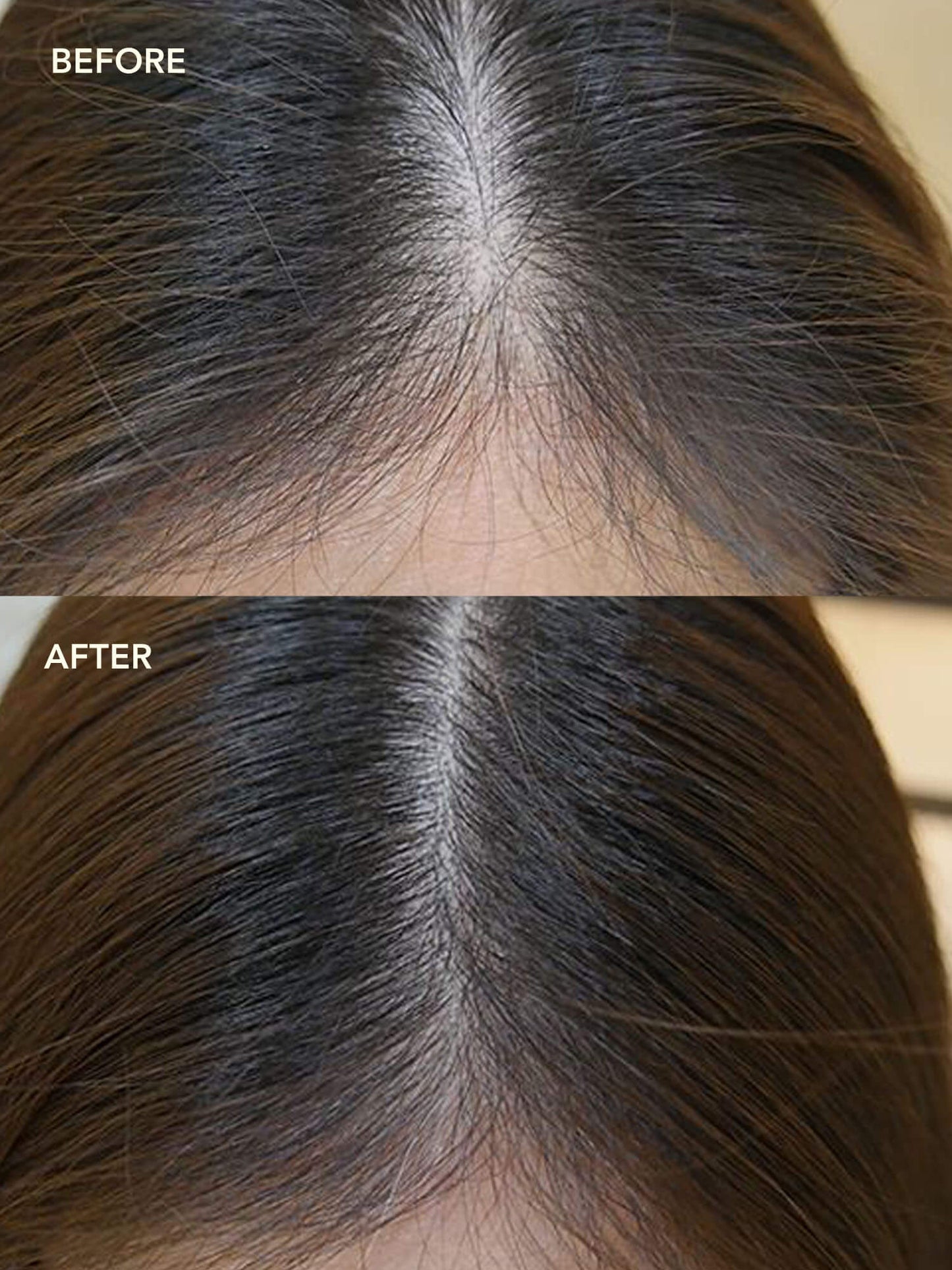 SHIKAKAI + BHRINGRAJ Stimulating Scalp Serum for Hair Growth
