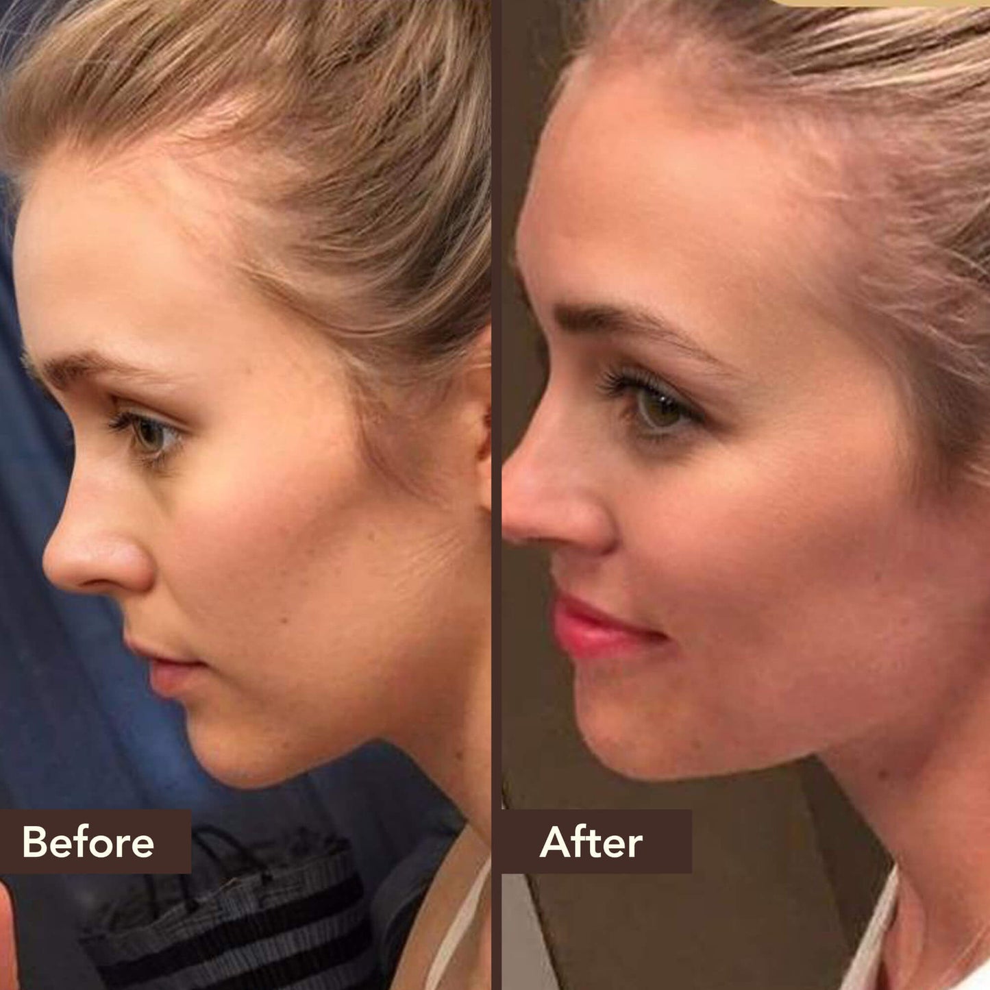 BHRINGRAJ Hair Growth Serum