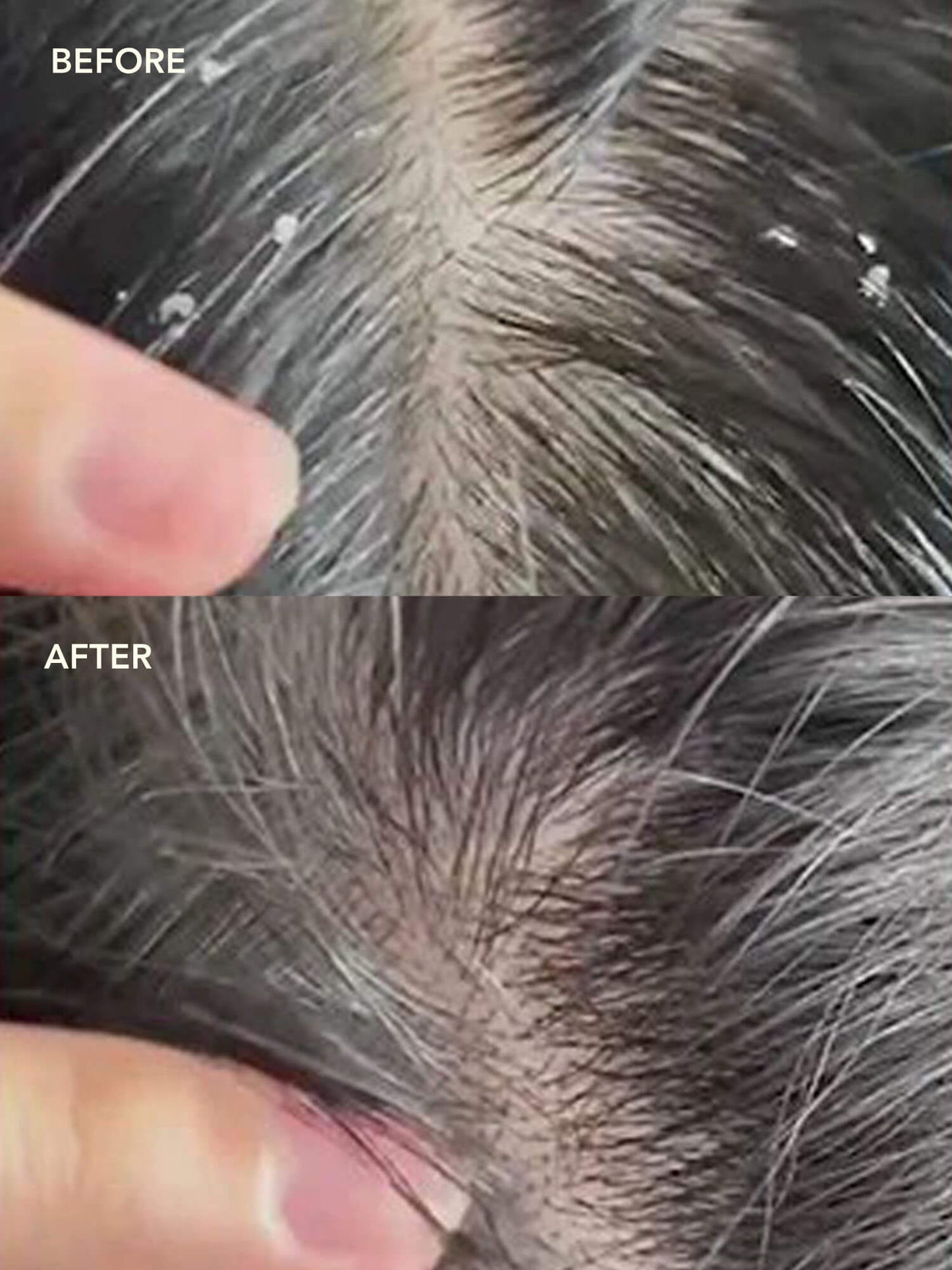 NEEM + SALICYLIC ACID Exfoliating Scalp Serum