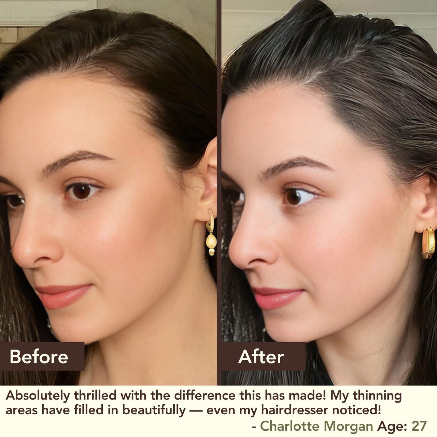 SHIKAKAI + BHRINGRAJ Hair Growth Scalp Serum