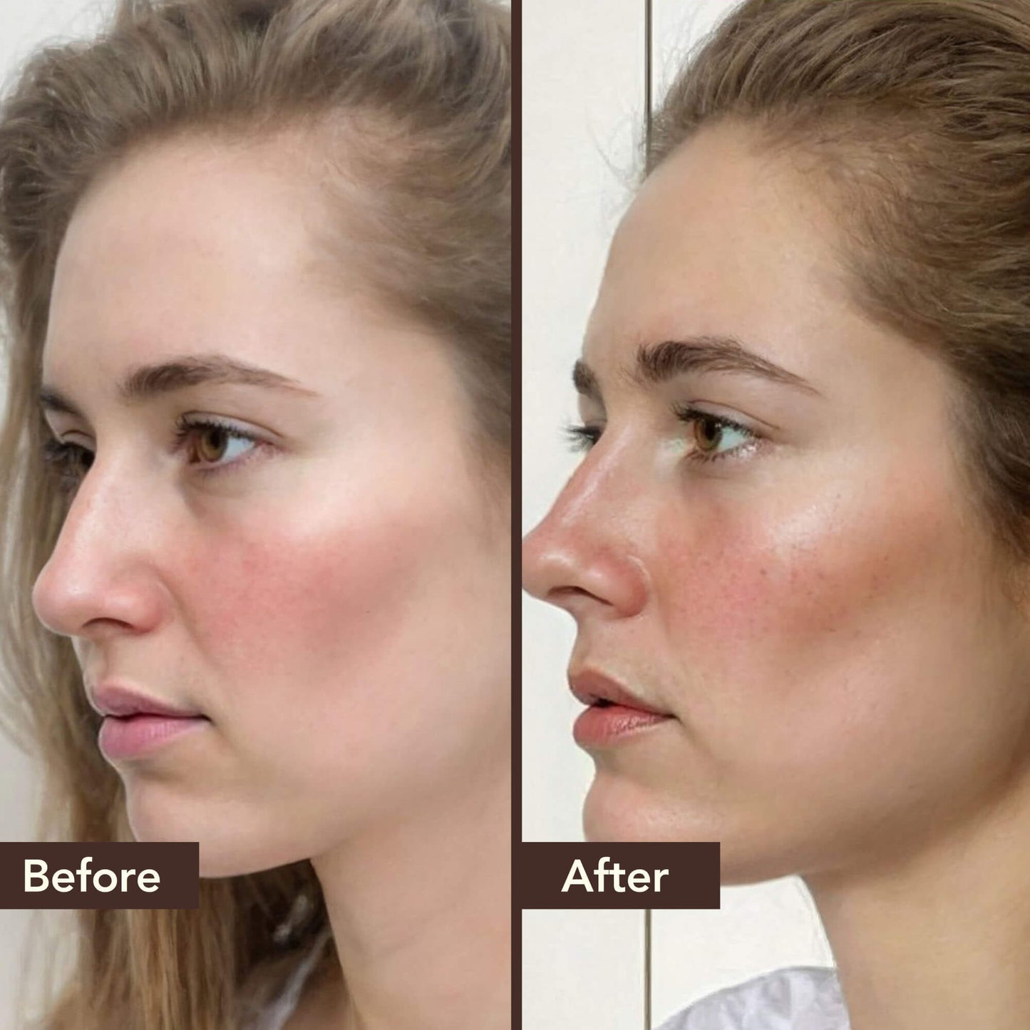 BHRINGRAJ Hair Growth Serum