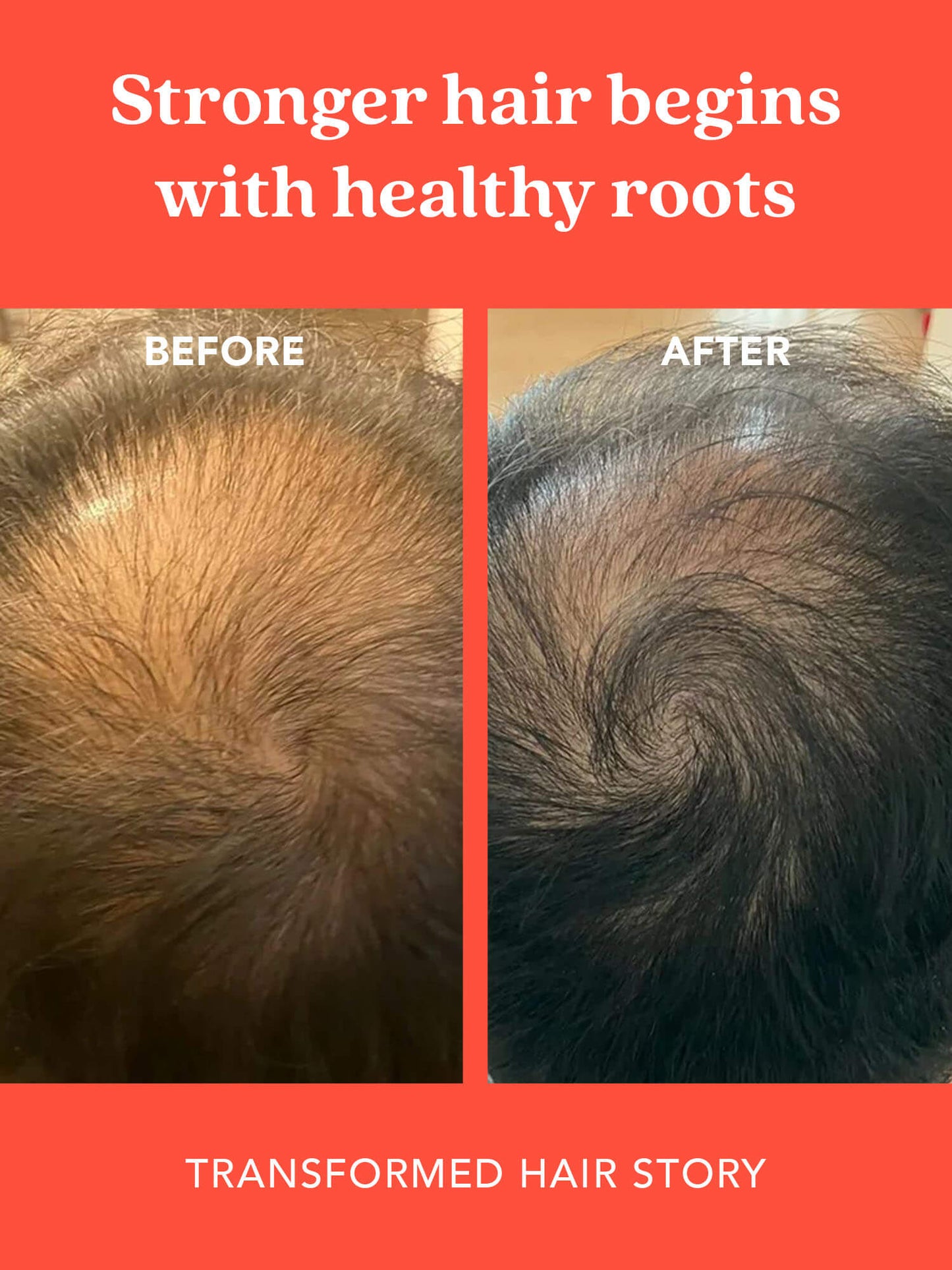 SHIKAKAI + BHRINGRAJ Stimulating Scalp Serum for Hair Growth for MEN