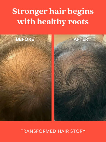 SHIKAKAI + BHRINGRAJ Stimulating Scalp Serum for Hair Growth for MEN
