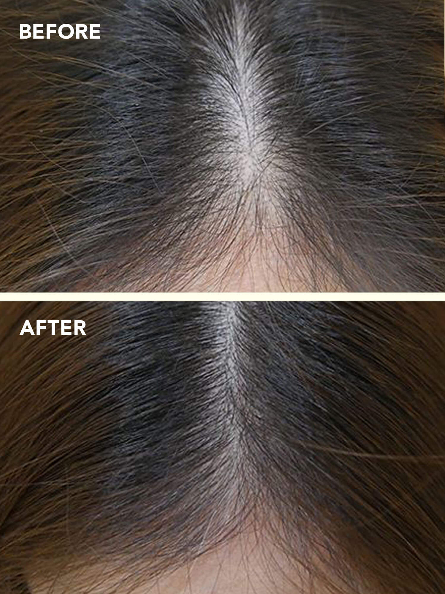 Hair Fall