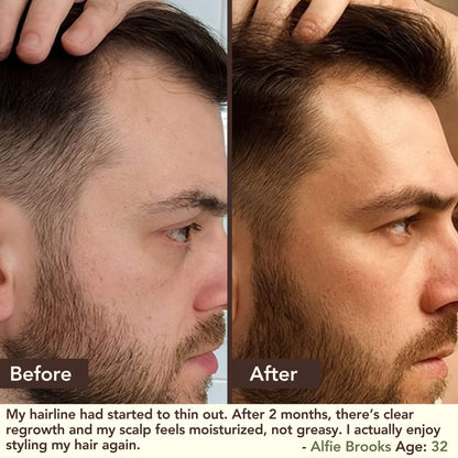 SHIKAKAI + BHRINGRAJ Hair Growth Scalp Serum for MEN