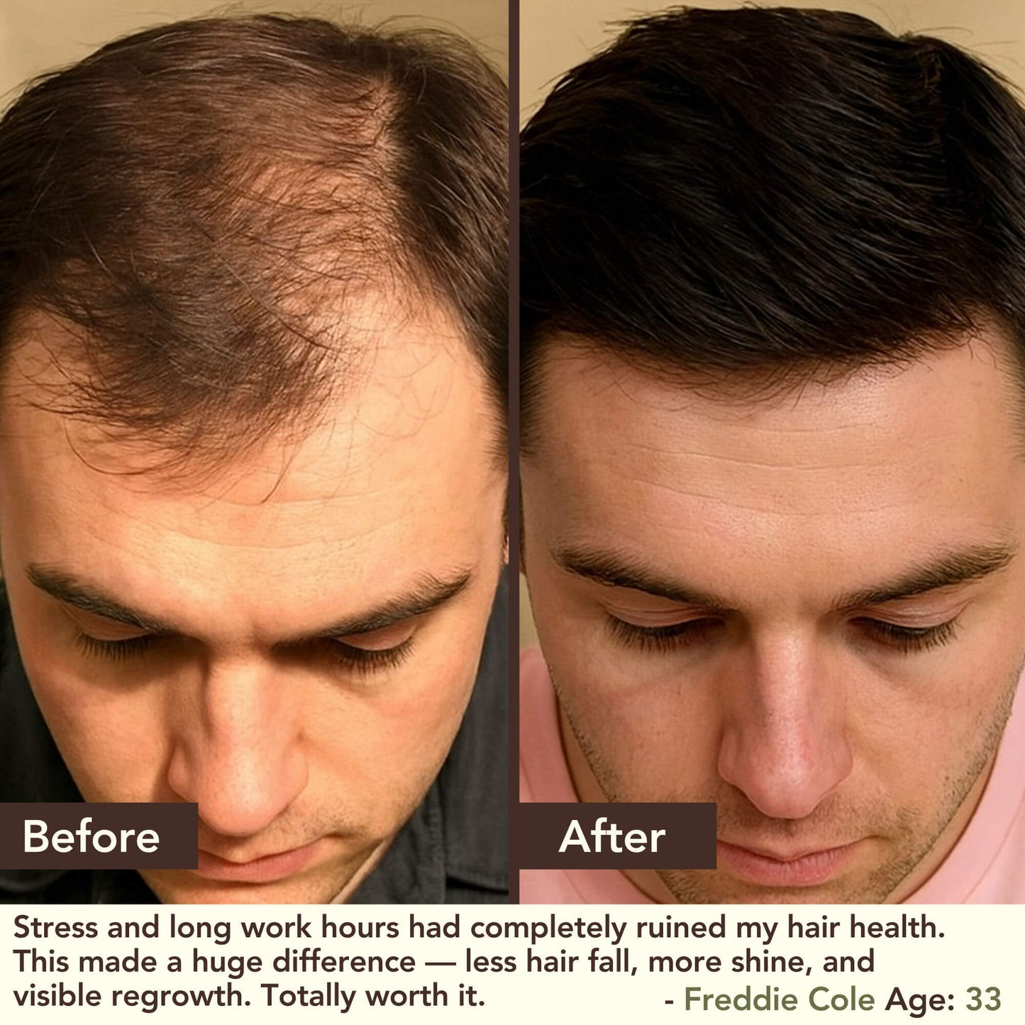 SHIKAKAI + BHRINGRAJ Hair Growth Scalp Serum for MEN