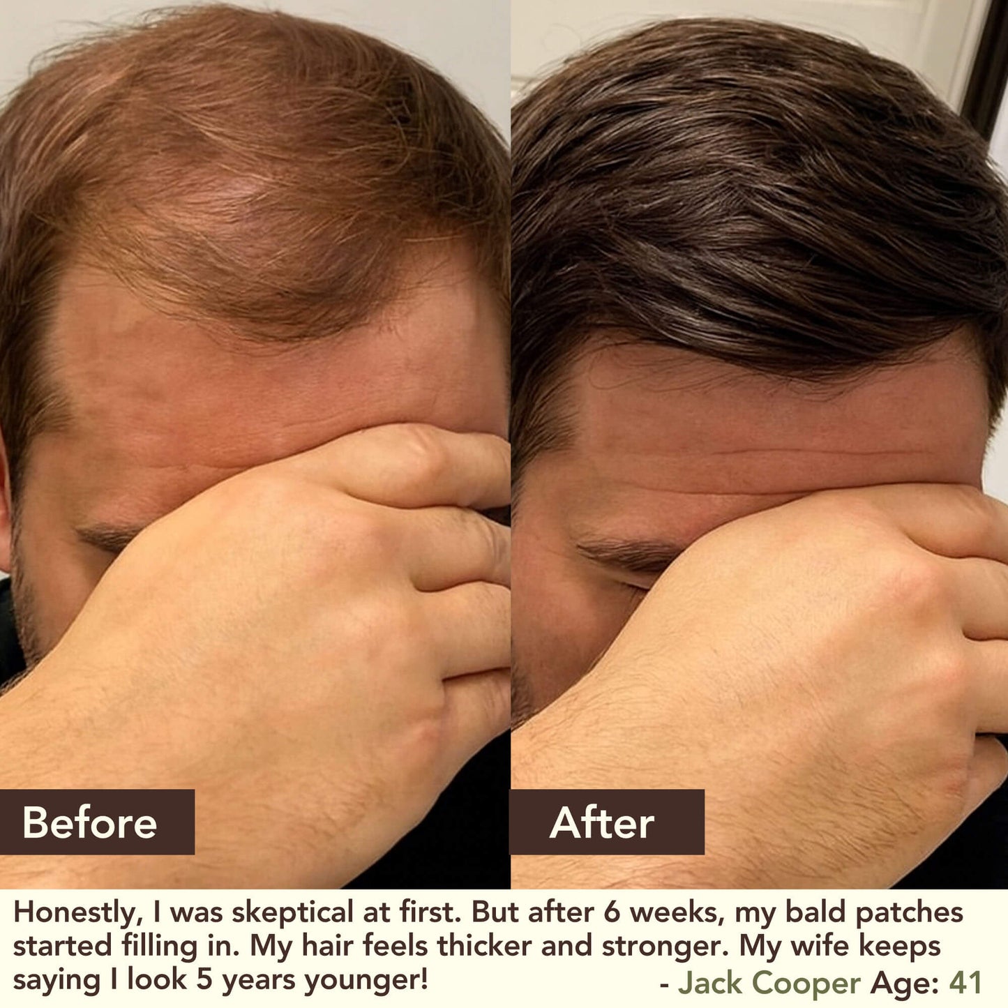 SHIKAKAI + BHRINGRAJ Hair Growth Scalp Serum for MEN