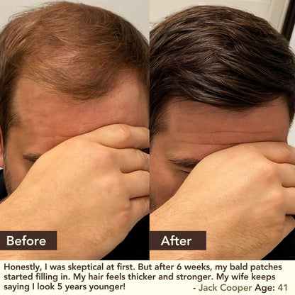 SHIKAKAI + BHRINGRAJ Hair Growth Scalp Serum for MEN