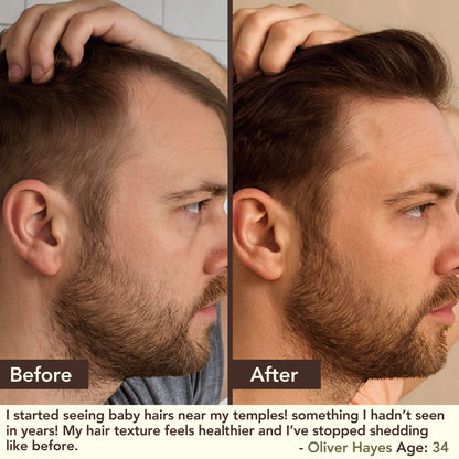 SHIKAKAI + BHRINGRAJ Hair Growth Scalp Serum for MEN