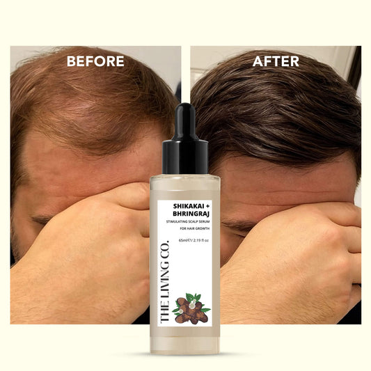 SHIKAKAI + BHRINGRAJ Hair Growth Scalp Serum for MEN