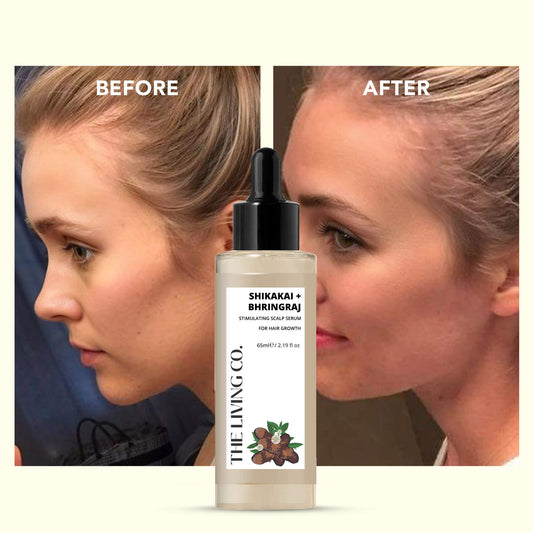 SHIKAKAI + BHRINGRAJ Hair Growth Scalp Serum